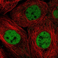 RBM7 Antibody, Novus Biologicals 25 &mu;L, Unlabeled:Antibodies, Polyclonal
